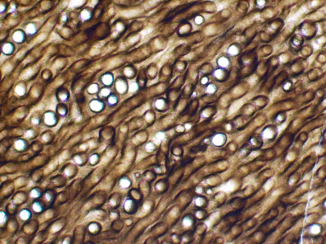 File:Prototaxites microstructure.jpg