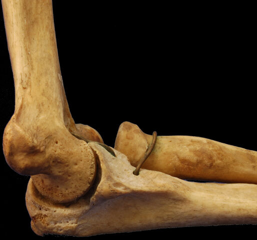 File:MedialHumerusRadiusUlnaArticulated.jpg.jpg