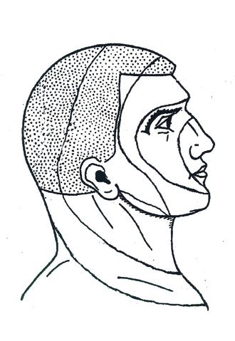 File:Onion Skin.png