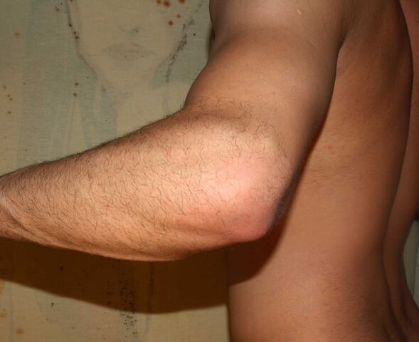 File:Elbow by David Shankbone.jpg