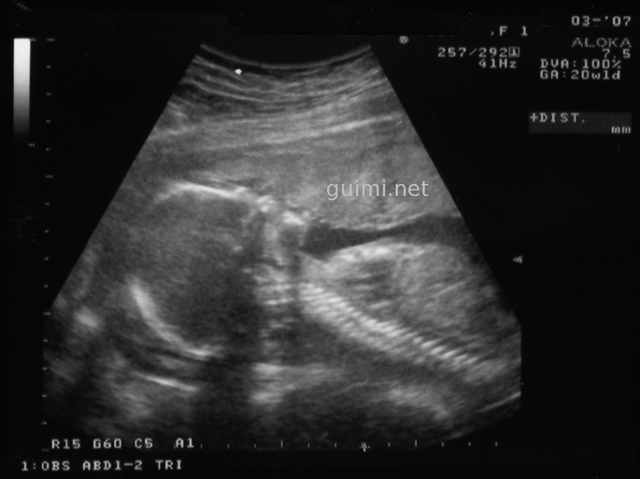 File:Scan20semanas1.png