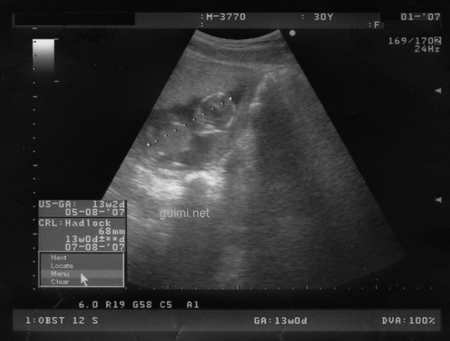 File:Scan13semanas1.png