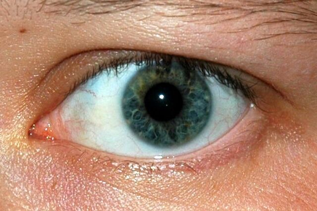 File:Oeil better.jpg