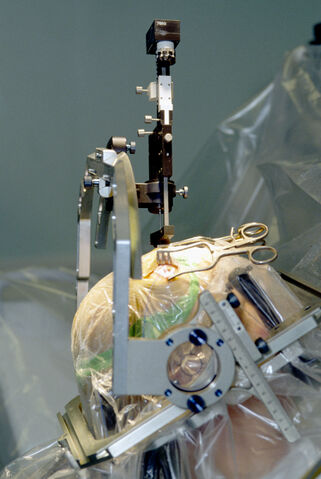 File:Parkinson surgery.jpg