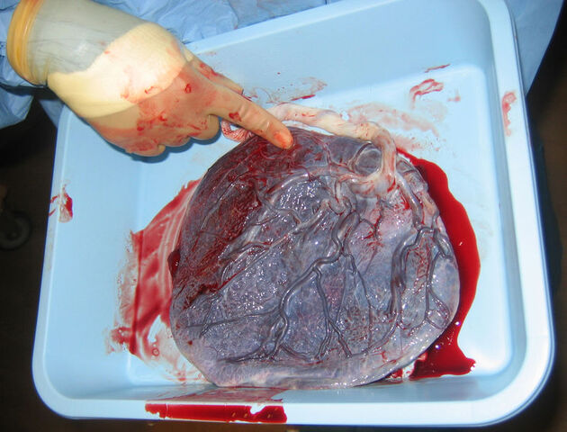 File:Human placenta baby side.jpg
