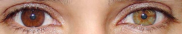 File:Heterochromiadeux.jpg
