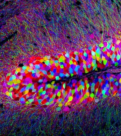 File:Braintissue.jpg