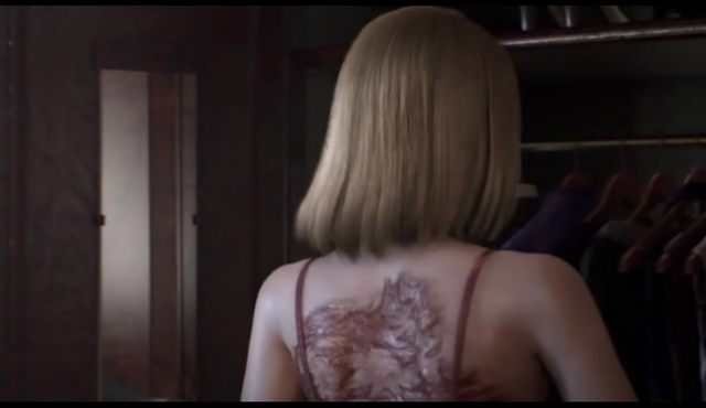 File:Svetlana scars.png