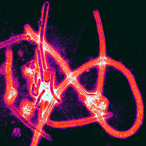 File:Ebolavirusx10000.jpg