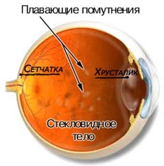 Steklovidnoe telo glaza