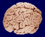 Brain 090407.jpg