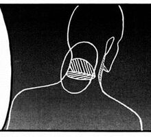 Titan Nape Diagram.jpg