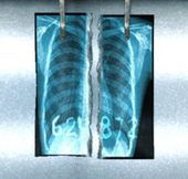 Silent-Hill-Homecoming-xray2