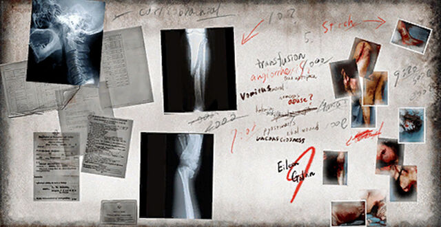 File:X-Ray Board.jpg