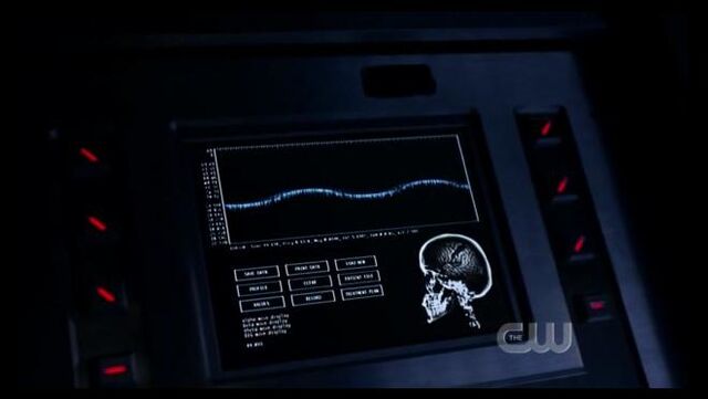 File:Brain monitoring.jpg