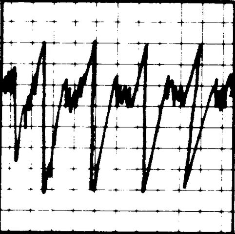 File:EKG Human.png