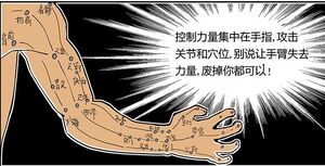 Acupuncture