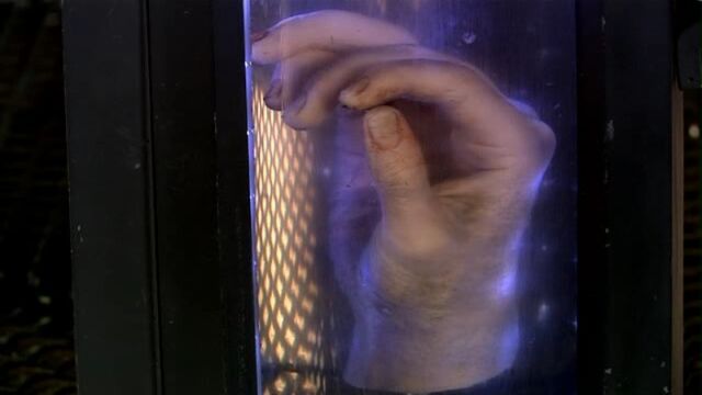 File:Doctors hand.jpg