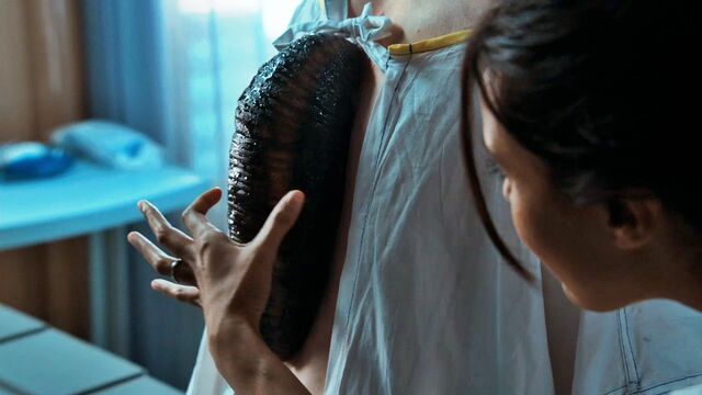File:250px-Hyperoxic Leech.jpg