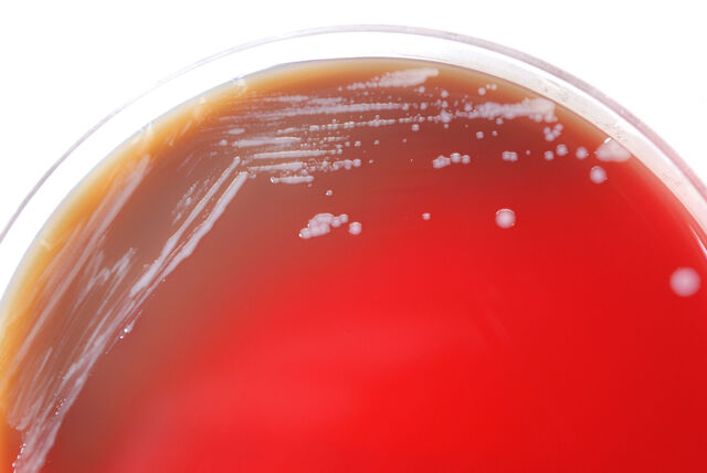 File:Burkholderia mallei.jpg