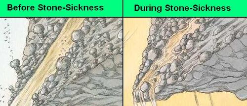Stonesickness