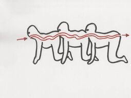 Surgery diagram