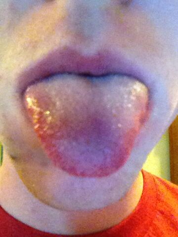 File:tounge.jpg