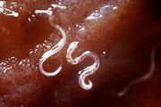 Hoookworm