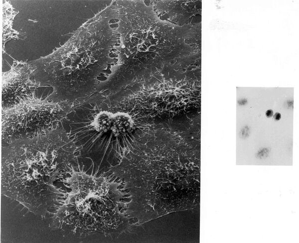 File:739px-Hela Cells Image 3709-PH.jpeg