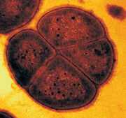 Deinococcusradiodurans4