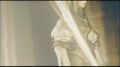 Thumbnail for version as of 10:22, March 5, 2008