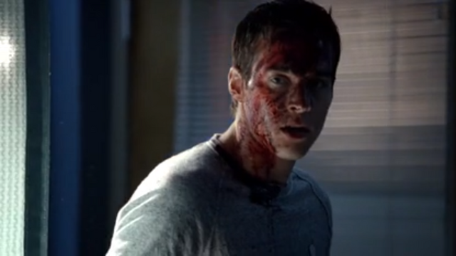 File:Bloody-face-kai.png