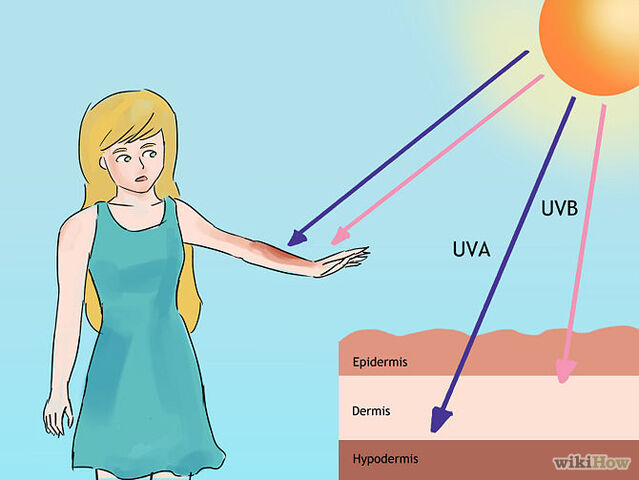File:Sunburn.jpg