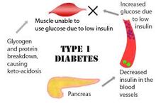 Diabetes