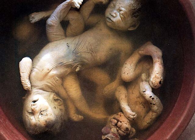 File:Agent-orange-dead-deformed-babies.jpg