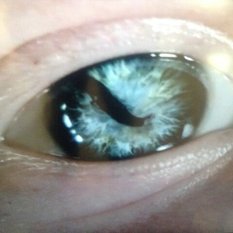 File:Sigurd-snake-in-th-eye.jpg