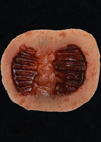 File:Walker Large Bites Appliance.jpg
