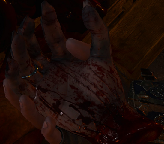 File:Tw3 Unusual severed hand detail.png