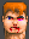 Injuredface