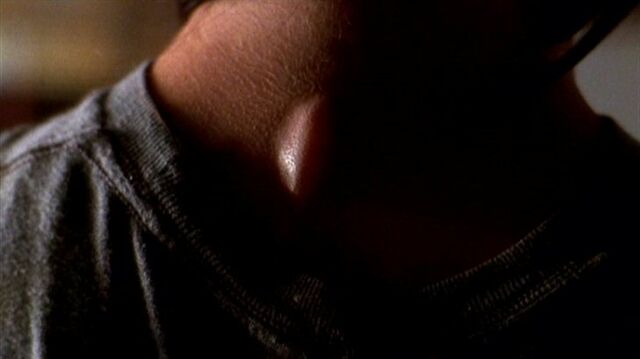 File:Shannon McMahon's neck.jpg